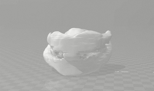 Final cleaned-up 3D model of the patient's oral structure