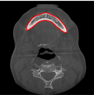 Oral structure segmented from an axial CT slice, outlined in red